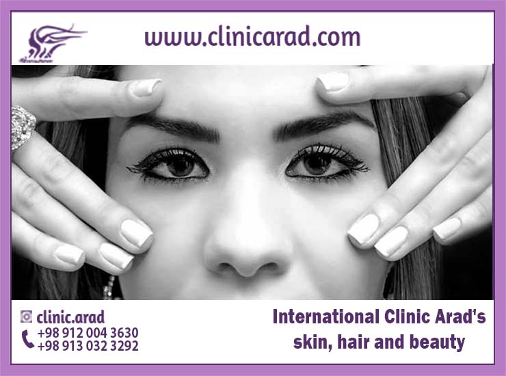 behind eyelid Surgery گردشگری سلامت آنلاین