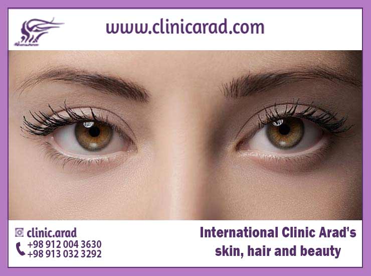 Cost of Puffy Eye Surgery گردشگری سلامت آنلاین