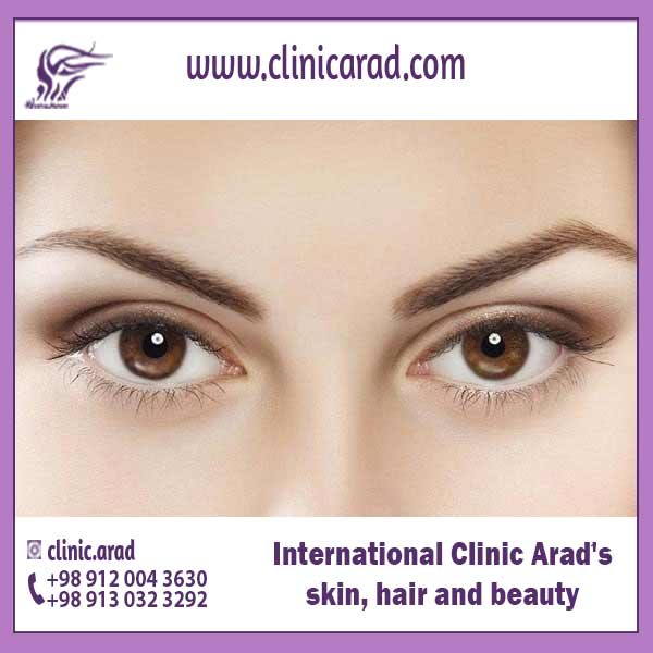 Cost of Puffy Eye Surgery گردشگری سلامت آنلاین